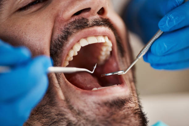 Best After-Hours Emergency Dentist in Meadowlakes, TX